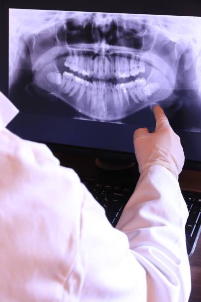 Best Emergency Root Canal Treatment in Sebastian, TX