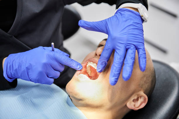Best Emergency Dental Services for Seniors in Sebastian, TX