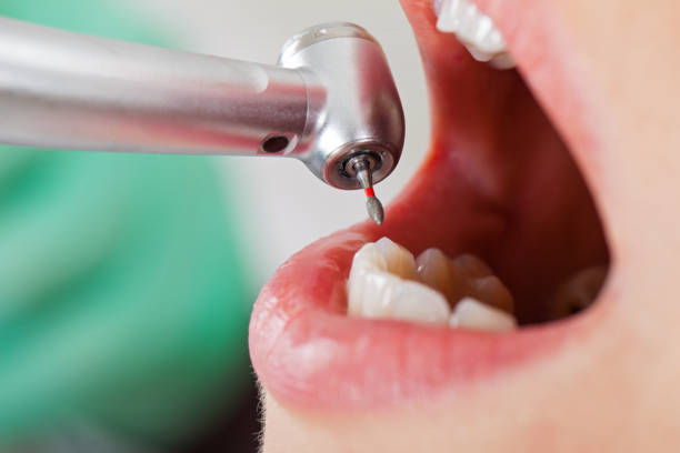 Best Holiday Emergency Dentist in Sebastian, TX